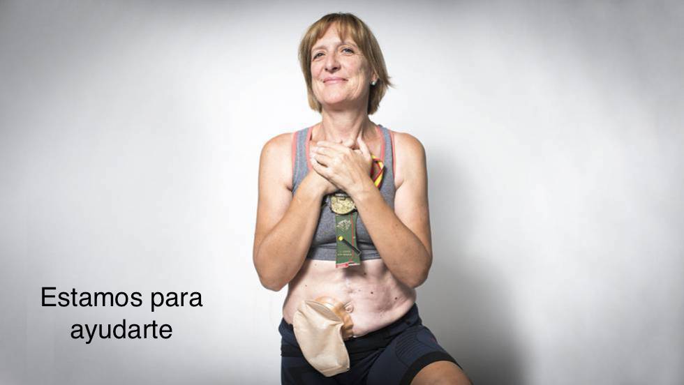 Cuidado y entrenamiento de pacientes con Colostomías. Realización y reconexión.