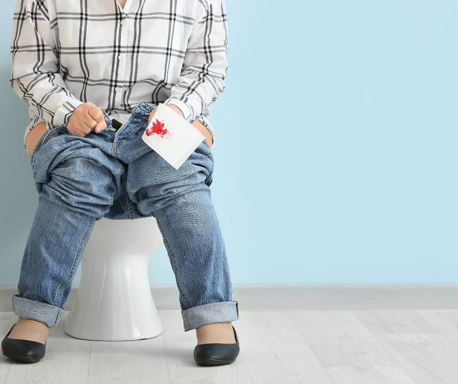 Hemorroides: mitos, verdades y cuándo realmente es necesario un tratamiento