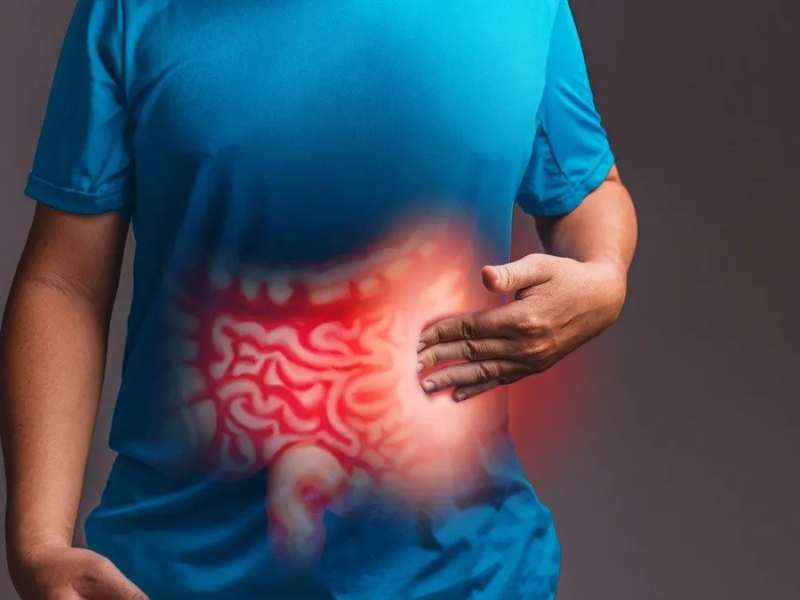 Dolor abdominal: por qué no todo es colitis